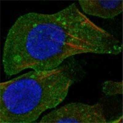 Immunocytochemistry/ Immunofluorescence: DDR2 Antibody (3B11E4) - BSA Free [NBP1-28883]