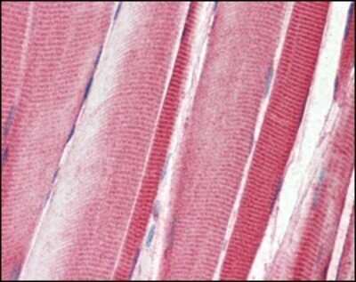 Immunohistochemistry-Paraffin: DDR2 Antibody (3B11E4) - BSA Free [NBP1-28883]