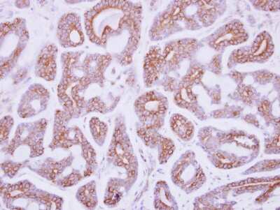 Immunohistochemistry-Paraffin: DDR2 Antibody [NBP2-14926]