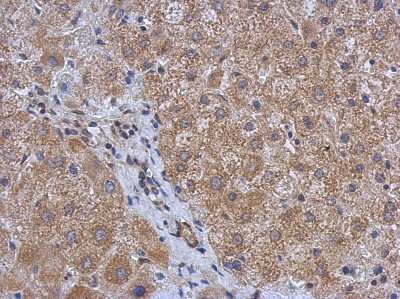Immunohistochemistry-Paraffin: DDR2 Antibody [NBP2-14927]