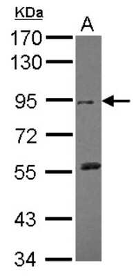 Western Blot: 0 [NBP2-14927]