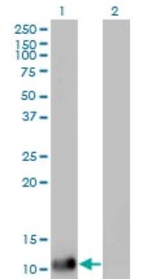 Western Blot: DDT Antibody (1G1) [H00001652-M01]
