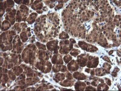 Immunohistochemistry: DDT Antibody (OTI1H3) [NBP2-45677]