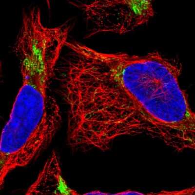 Immunocytochemistry/ Immunofluorescence: DDT Antibody [NBP2-13904]