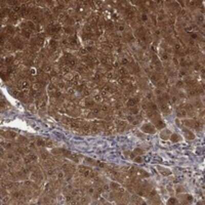 Immunohistochemistry-Paraffin: DDT Antibody [NBP3-17653]