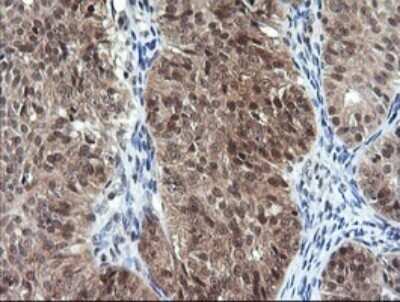 Immunohistochemistry: DDT Antibody (OTI1H3) - Azide and BSA Free [NBP2-70562]