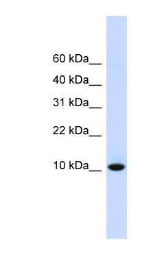 Western Blot: DDT Antibody [NBP1-53202]