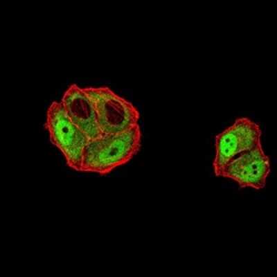 Immunocytochemistry/ Immunofluorescence: DDX1 Antibody (3E5B2) - BSA Free [NBP2-61744]