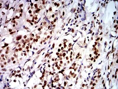 Immunohistochemistry-Paraffin: DDX1 Antibody (3E5E2) - BSA Free [NBP2-61745]