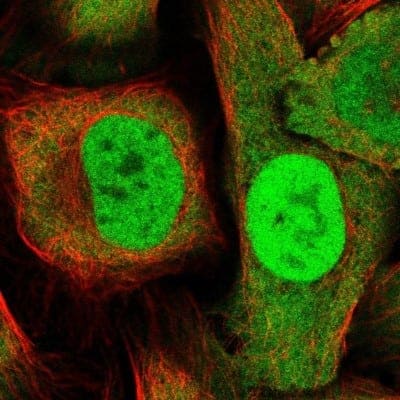 Immunocytochemistry/ Immunofluorescence: DDX1 Antibody [NBP1-85293]
