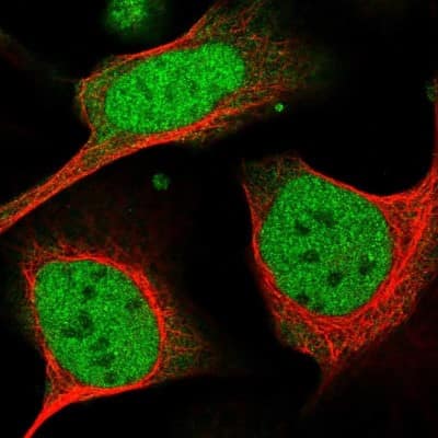 Immunocytochemistry/ Immunofluorescence: DDX1 Antibody [NBP1-85294]