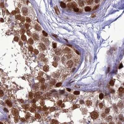 Immunohistochemistry-Paraffin: DDX1 Antibody [NBP1-85293]