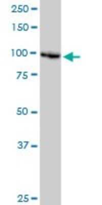 Western Blot: DDX11 Antibody (3C1) [H00001663-M03]