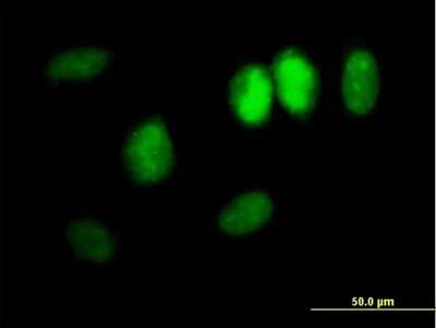 Immunocytochemistry/ Immunofluorescence: DDX11 Antibody [H00001663-B01P]