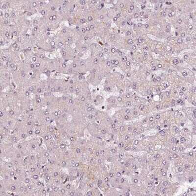 Immunohistochemistry-Paraffin: DDX11 Antibody [NBP2-38060]