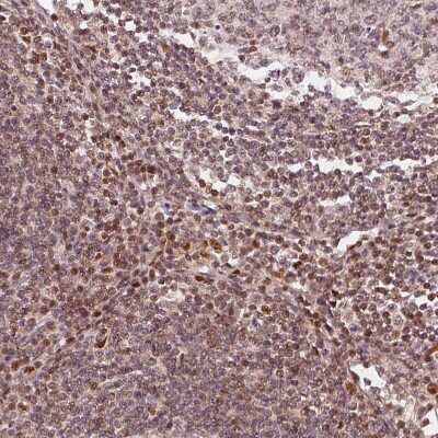 Immunohistochemistry-Paraffin: DDX11 Antibody [NBP2-38060]