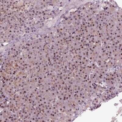 Immunohistochemistry-Paraffin: DDX11 Antibody [NBP2-38060]