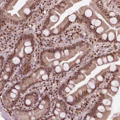 Immunohistochemistry-Paraffin: DDX11 Antibody [NBP2-38060]