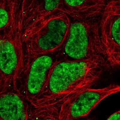 Immunocytochemistry/ Immunofluorescence: DDX17 Antibody [NBP2-38985]