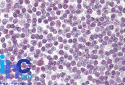 Immunohistochemistry-Paraffin: DDX18 Antibody [NBP2-27353]