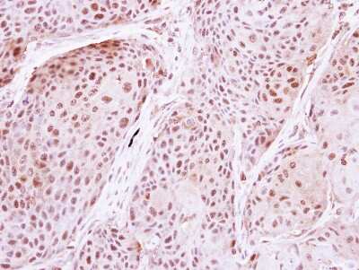 Immunohistochemistry-Paraffin: DDX19B Antibody [NBP2-16126]