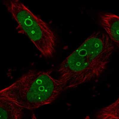 Immunocytochemistry/ Immunofluorescence: DDX21 Antibody [NBP1-83310]