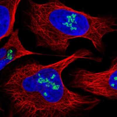Immunocytochemistry/ Immunofluorescence: DDX21 Antibody [NBP2-38311]