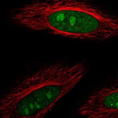 Immunocytochemistry/ Immunofluorescence: DDX23 Antibody [NBP2-58799]