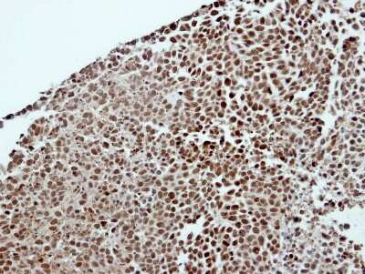 Immunohistochemistry-Paraffin: DDX23 Antibody [NBP2-16129]