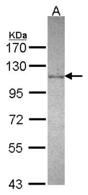 Western Blot: DDX23 Antibody [NBP2-16129]