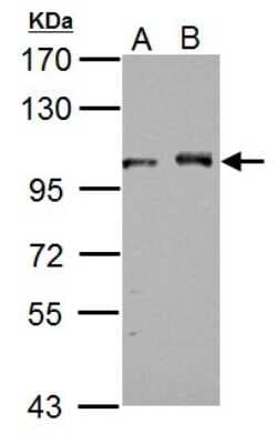 Western Blot: DDX23 Antibody [NBP2-16130]