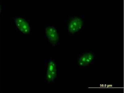 Immunocytochemistry/ Immunofluorescence: DDX24 Antibody [H00057062-B01P]
