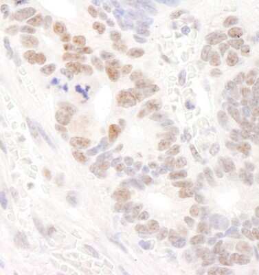 Immunohistochemistry-Paraffin: DDX24 Antibody [NB100-2226]