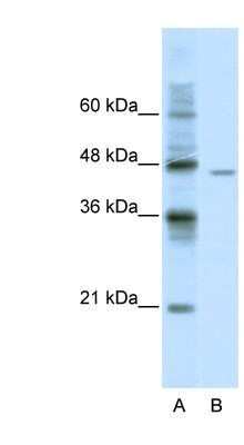 Western Blot: DDX25 Antibody [NBP1-57341]