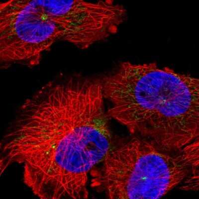 Immunocytochemistry/ Immunofluorescence: DDX26B Antibody [NBP2-55287]