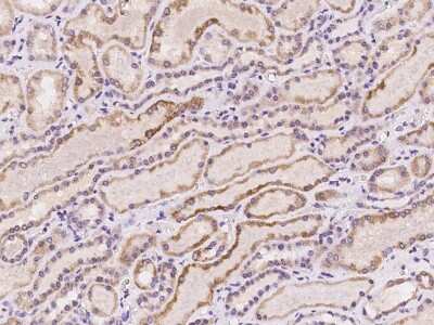 Immunohistochemistry-Paraffin: DDX26B Antibody [NBP2-98078]