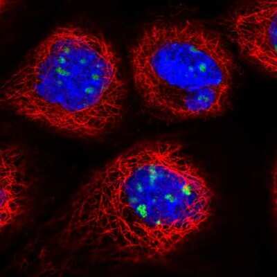 Immunocytochemistry/ Immunofluorescence: DDX27 Antibody [NBP1-91825]