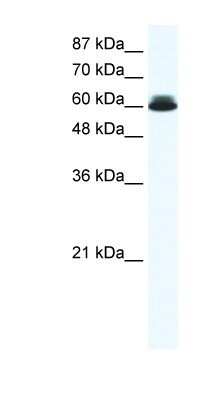 Western Blot: DDX27 Antibody [NBP1-57345]