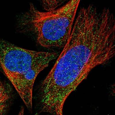 Immunocytochemistry/ Immunofluorescence: DDX28 Antibody [NBP1-83757]