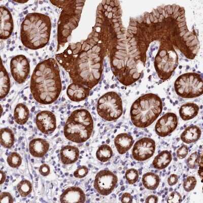 Immunohistochemistry-Paraffin: DDX28 Antibody [NBP1-83757]