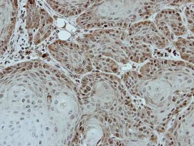 Immunohistochemistry-Paraffin: DDX28 Antibody [NBP2-16131]