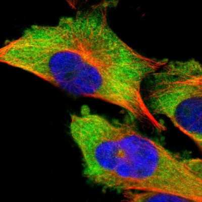 Immunocytochemistry/ Immunofluorescence: DDX3 Antibody [NBP1-85291]
