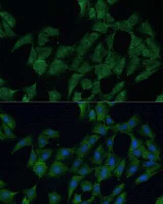 Immunocytochemistry/ Immunofluorescence: DDX3 Antibody - Azide and BSA Free [NBP2-92850]