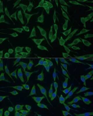 Immunocytochemistry/ Immunofluorescence: DDX3 Antibody - Azide and BSA Free [NBP2-92850]