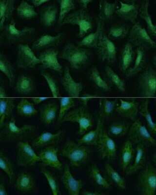 Immunocytochemistry/ Immunofluorescence: DDX3 Antibody - Azide and BSA Free [NBP2-92850]