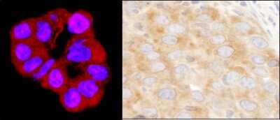 Immunohistochemistry: DDX3 Antibody [NB200-194]