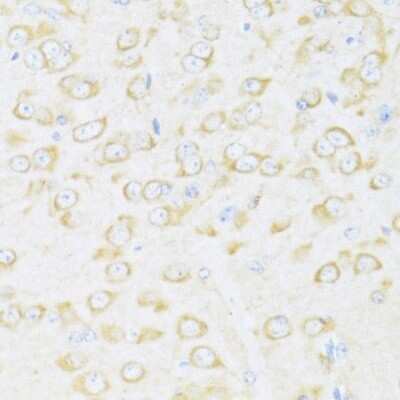 Immunohistochemistry-Paraffin: DDX3 Antibody - Azide and BSA Free [NBP2-92850]