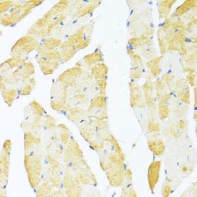 Immunohistochemistry-Paraffin: DDX3 Antibody - Azide and BSA Free [NBP2-92850]