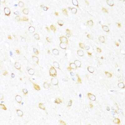 Immunohistochemistry-Paraffin: DDX3 Antibody - Azide and BSA Free [NBP2-92850]