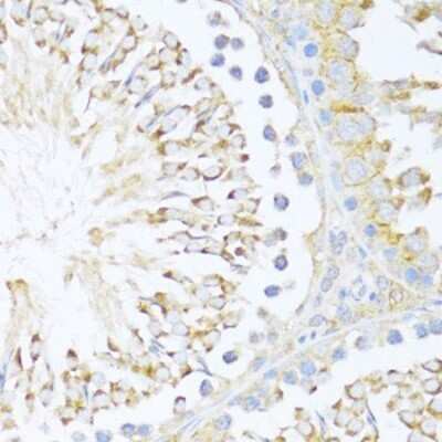 Immunohistochemistry-Paraffin: DDX3 Antibody - Azide and BSA Free [NBP2-92850]
